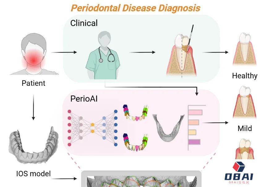 上科大沈定刚团队联合上海交大口腔医学院开发人工智能系统PerioAI助力牙周病精准诊断|CellPress对话科学家