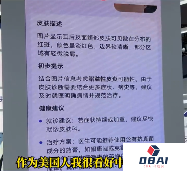 博主坦言美国看病太贵太麻烦：想把中国的AI医生带回去